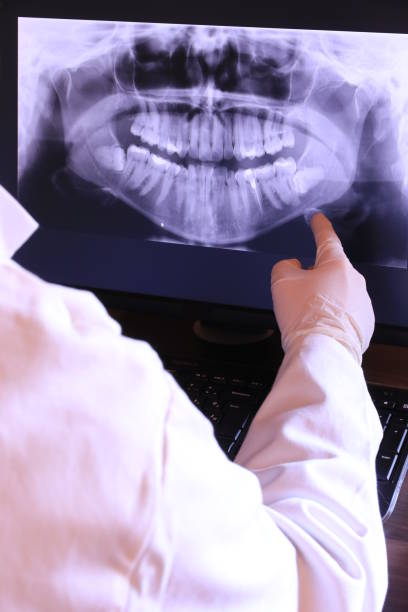Best Emergency Dental Care for Sports Injuries in Oelwein, IA