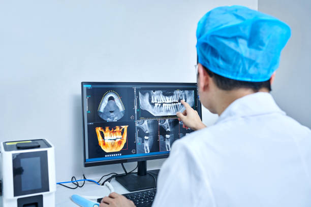 Best Knocked-Out Tooth (Avulsed Tooth) Treatment in Oelwein, IA